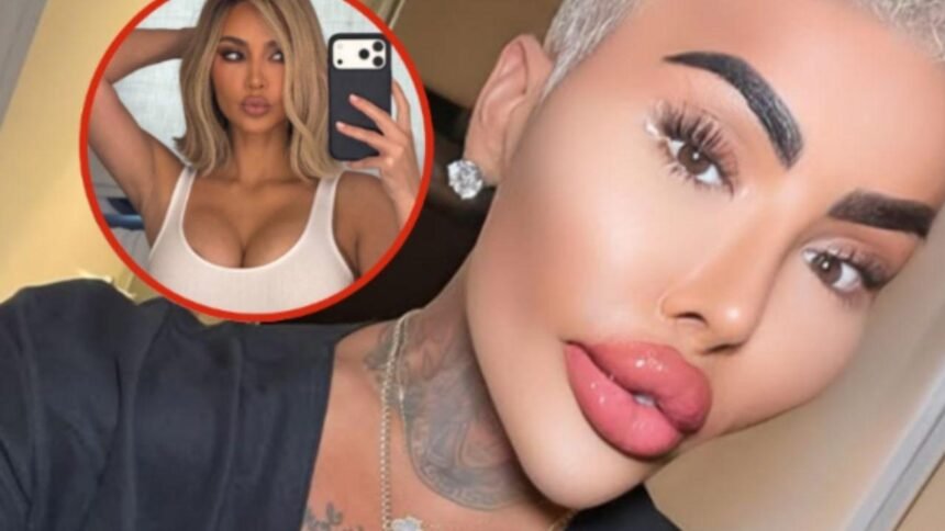 Fallece el influencer Jordan James Parke tras cirugía estética