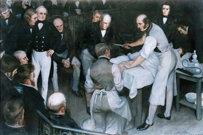 Robert Liston: la historia del cirujano más rápido de Londres